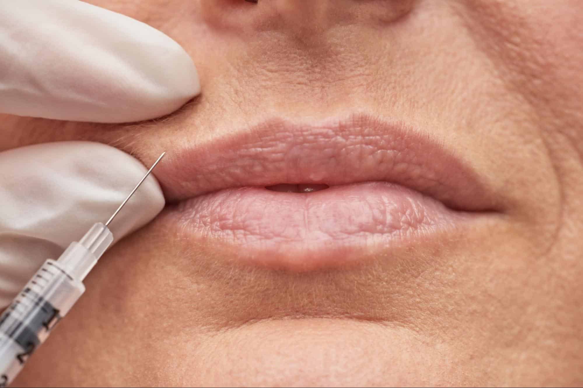 como quitar el codigo de barras del labio superior