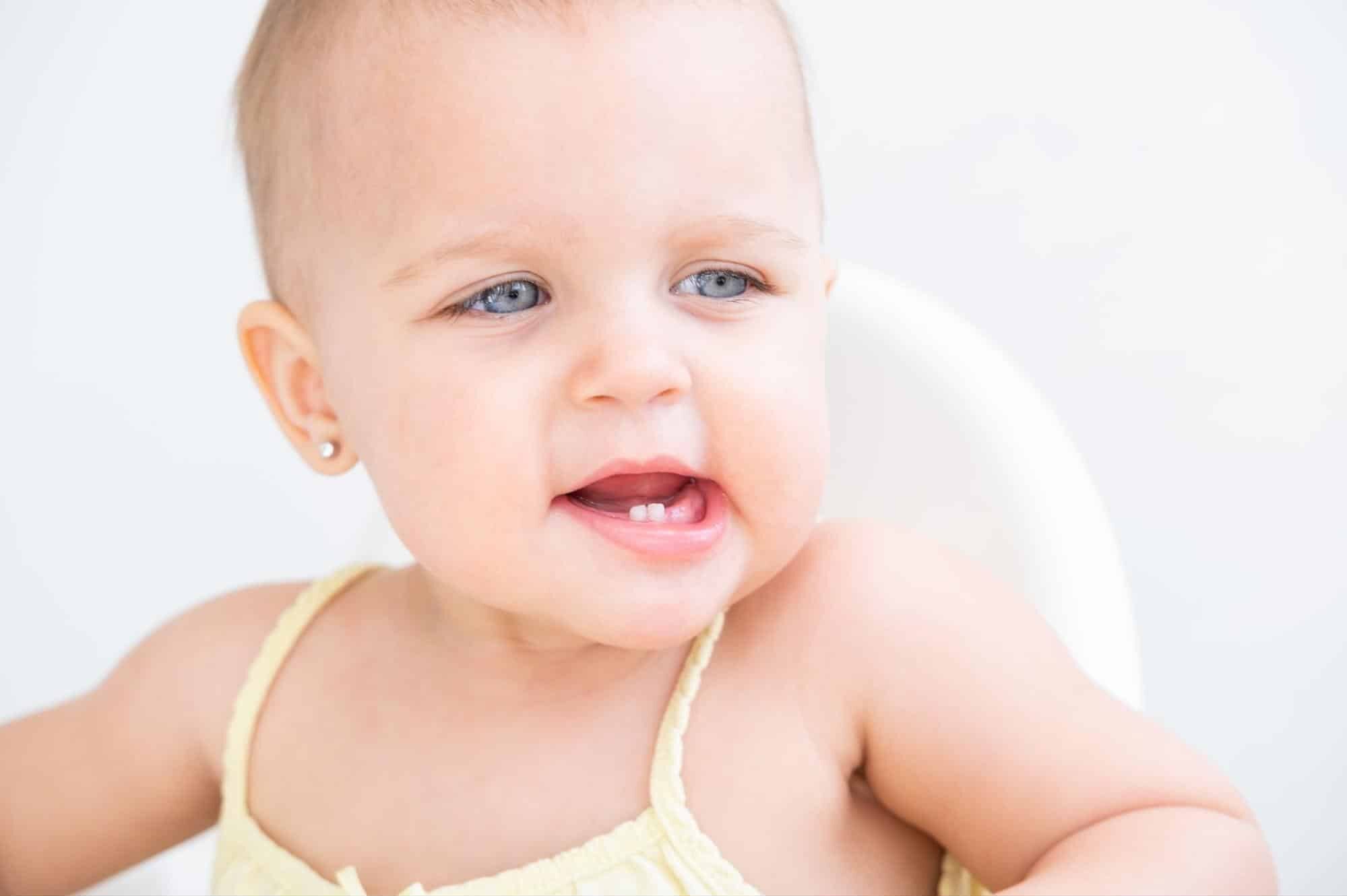 dientes natales y neonatales