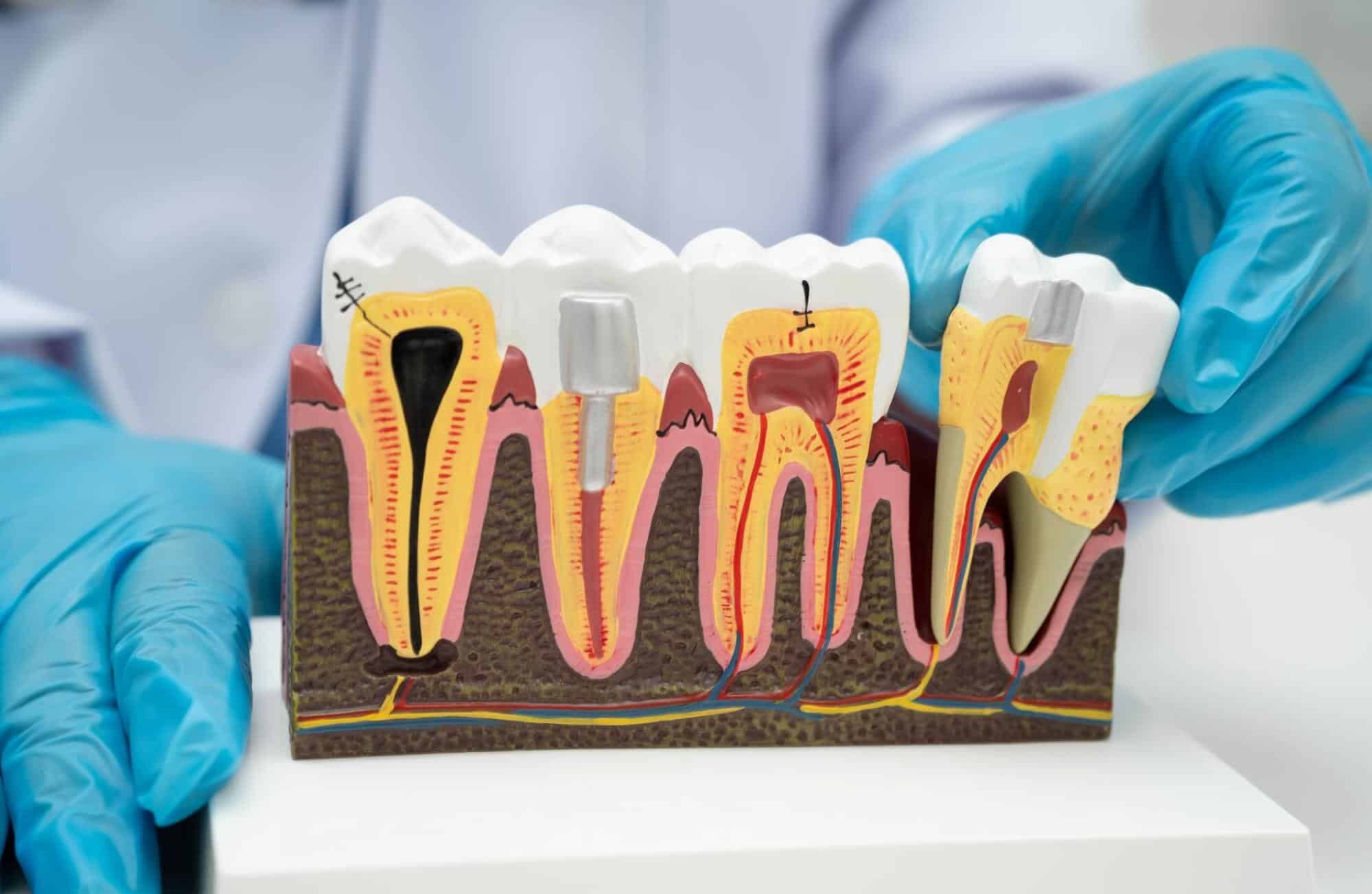 causas enfermedad periodontal