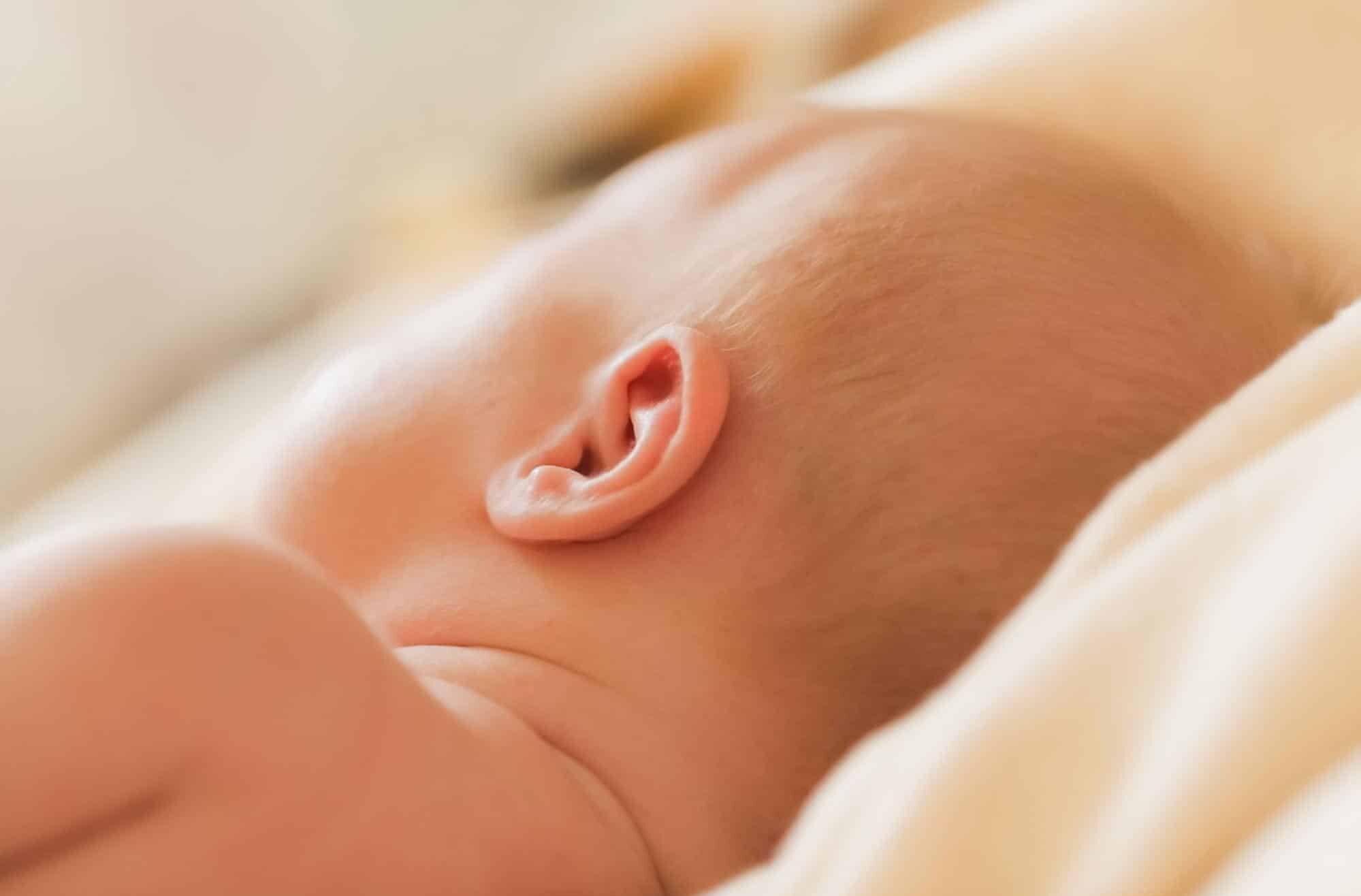 apendice preauricular