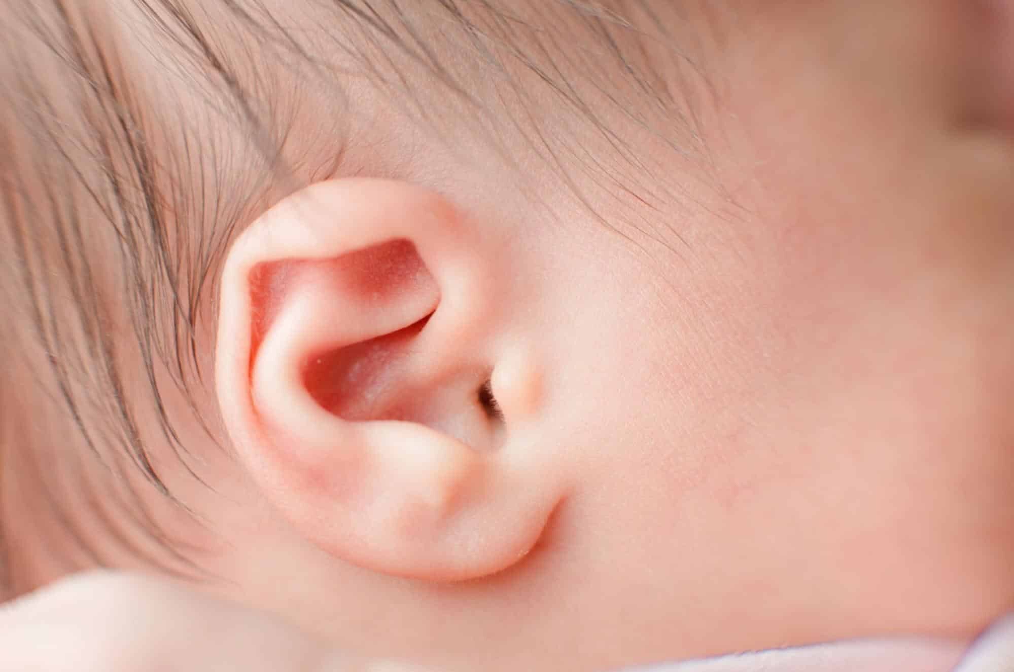 apendice preauricular recien nacidos